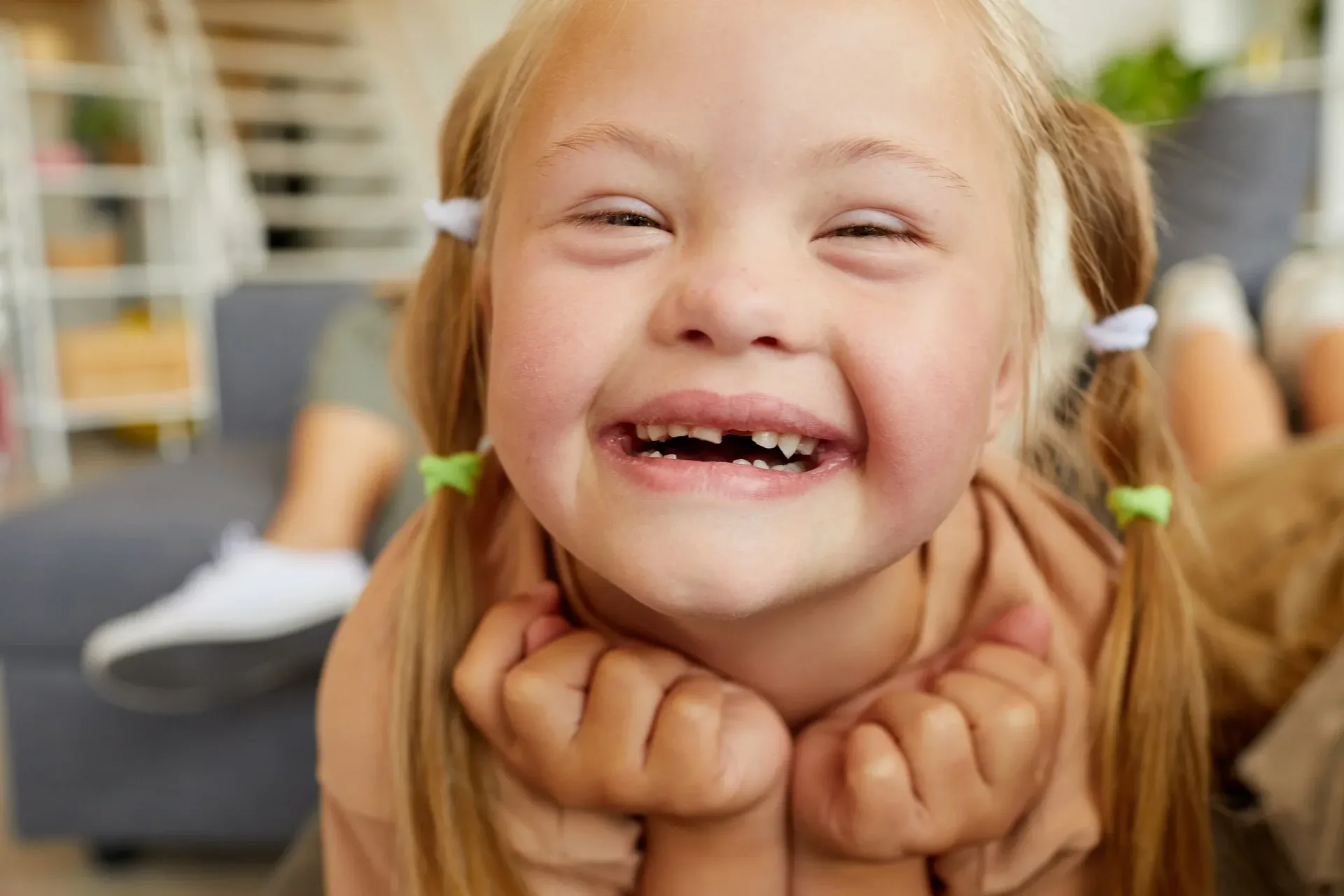 A child with special needs smiling